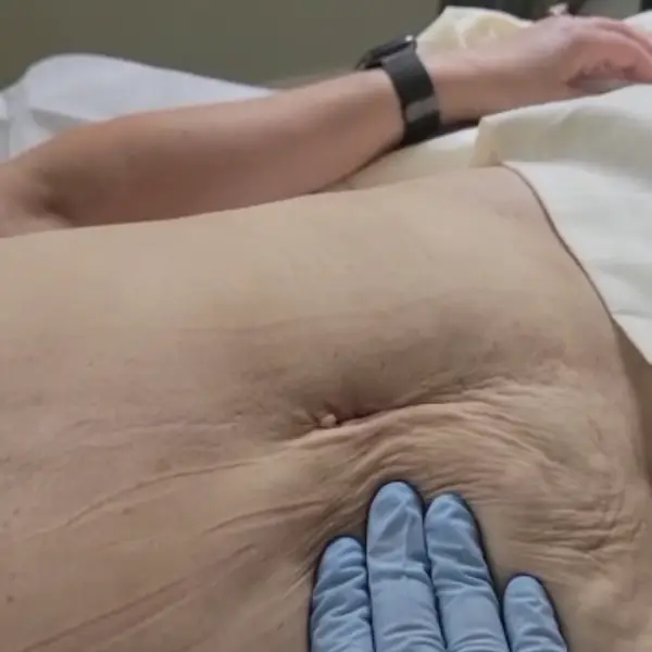 hand with glove on patient's tummy area